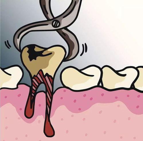 拔牙可以吃蜜瓜